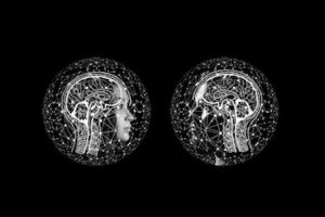black and white image of 2 MRI scans looking at eachother